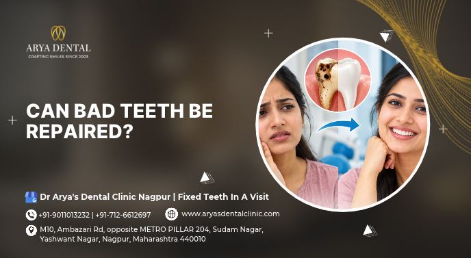Can bad teeth be repaired?