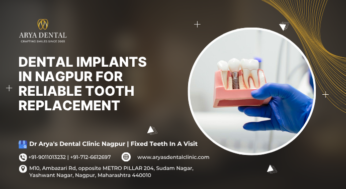 dental implants in nagpur for reliable tooth replacement