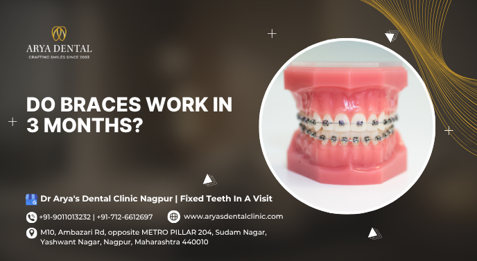braces treatment near me