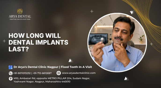 dental implants treatment