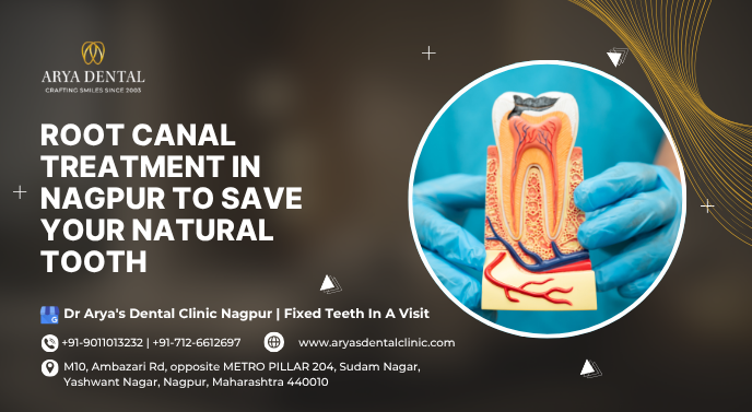 root canal treatment in nagpur to save your natural tooth