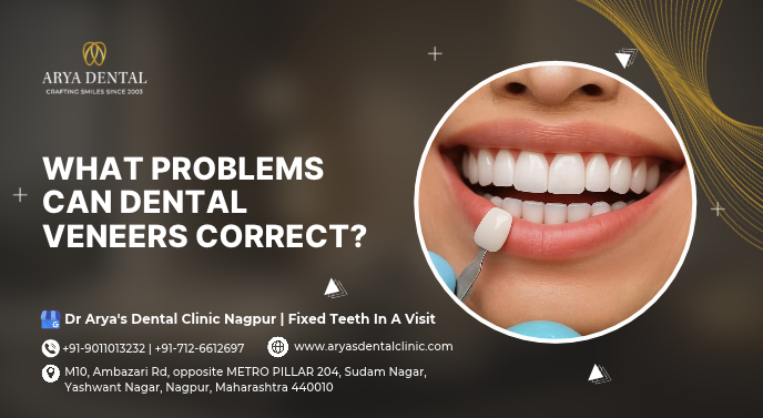 dental veneers near me