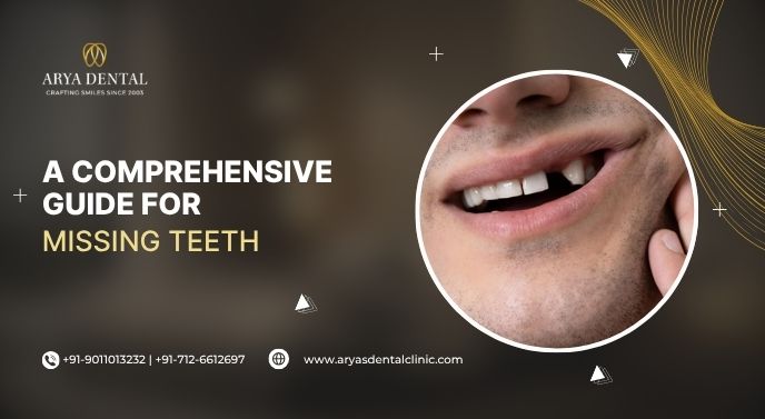 A Comprehensive Guide for Missing Teeth