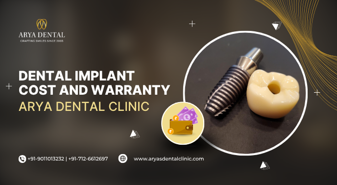Dental Implant Cost and Warranty Arya Dental Clinic