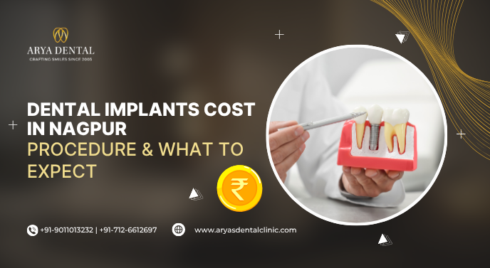 Dental Implants Cost in Nagpur