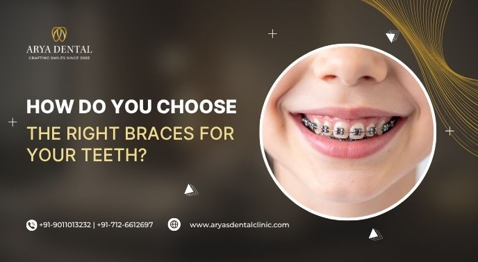 how do you choose the right braces for your teeth