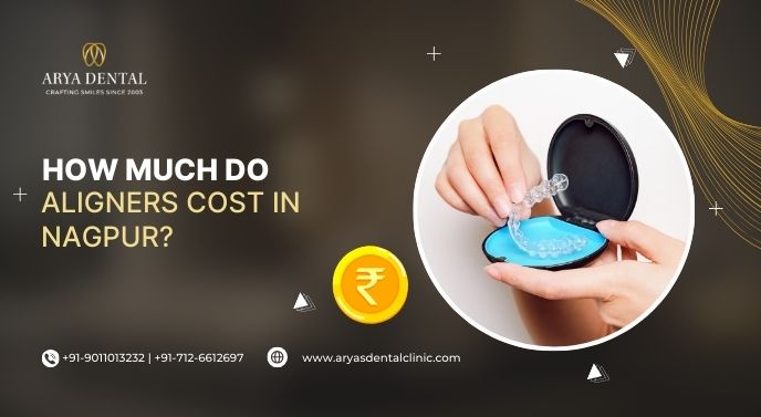 How Much Do Aligners Cost in Nagpur?