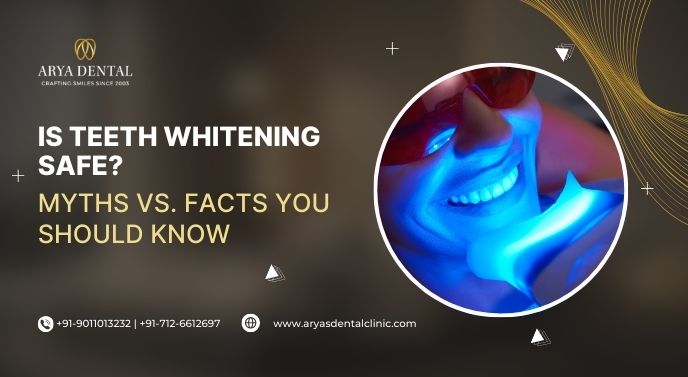 Is Teeth Whitening Safe? Myths vs. Facts You Should Know
