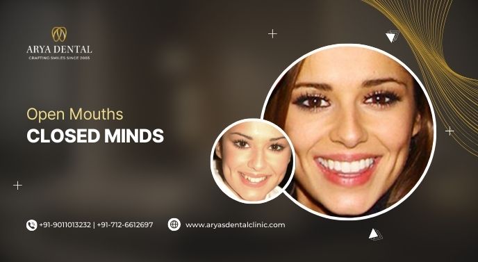 Open Mouths Closed Minds