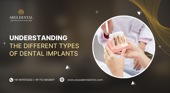 different types of dental implants