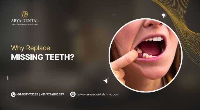 Why Replace Missing Teeth