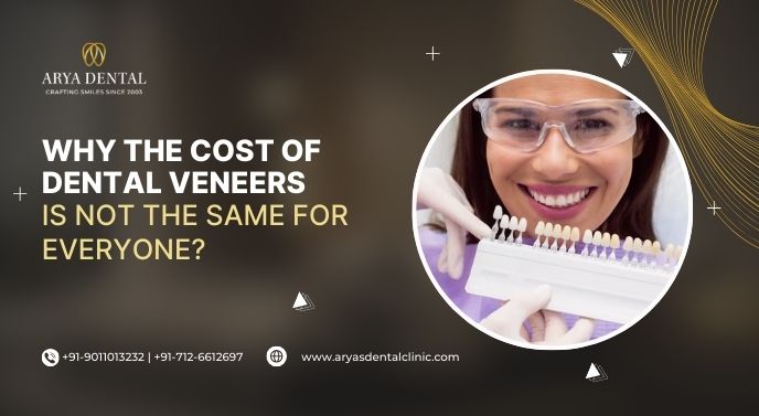 Why the Cost of Dental Veneers Is Not the Same for Everyone?